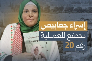 إسراء جعابيص تخضع للعملية رقم 20