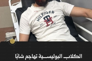 الكلاب البوليسية تهاجم شابًا مقدسيًا خلال اعتقال شقيقه