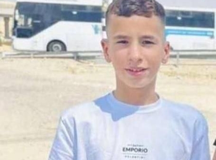 تمديد اعتقال فتى مقدسي يمكث في العناية المشددة !