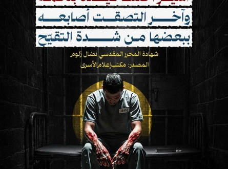 أسير اختلط قيده بلحمه.. شهادات صادمة !