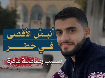 أنيس الأقصى في خطر بسبب رصاصة غادرة