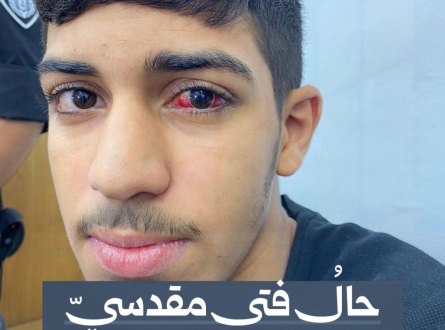 تعرض الفتى المقسي درويش للضرب والتعذيب في سجون الاحتلال