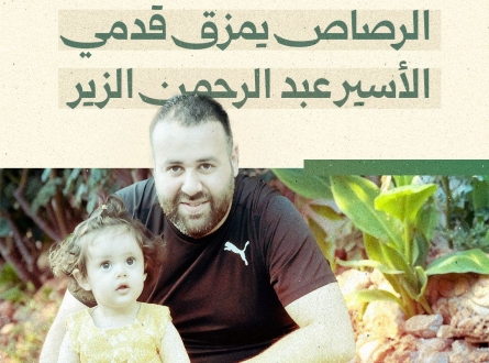 الرصاص يمزق قدمي الأسير عبد الرحمن الزير