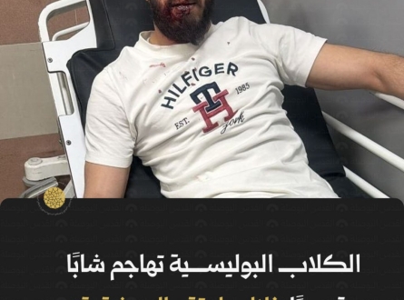 الكلاب البوليسية تهاجم شابًا مقدسيًا خلال اعتقال شقيقه